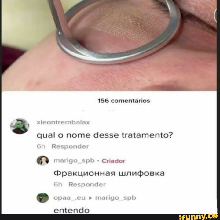 Goza Bate meigo Soca fofo O 40 Geme fino - iFunny Brazil