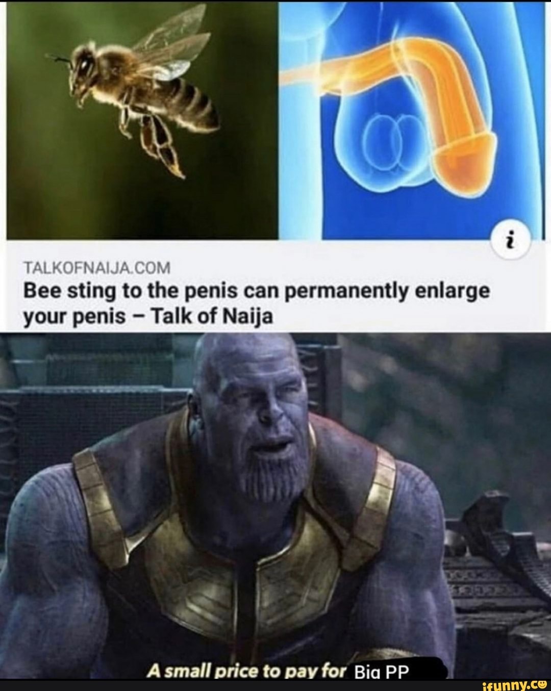 TALKOFNAIJA.COM Bee sting to the penis can permanently enlarge