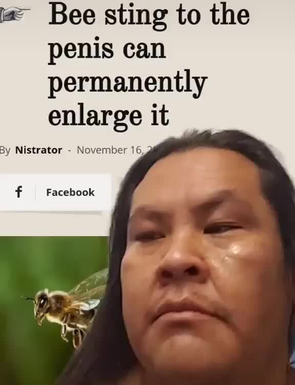 Bee sting to the penis can permanently enlarge it By Nistrator