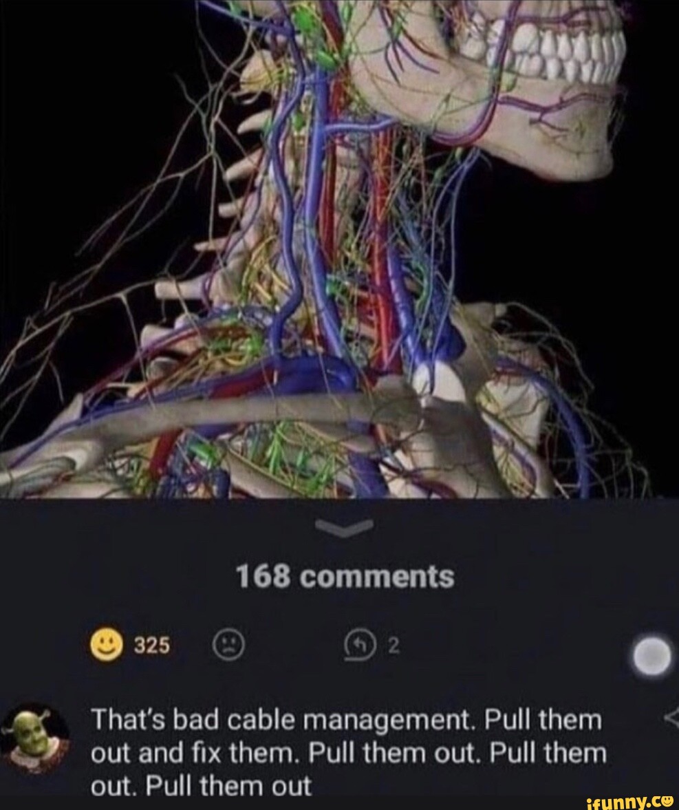 The bad cable management »