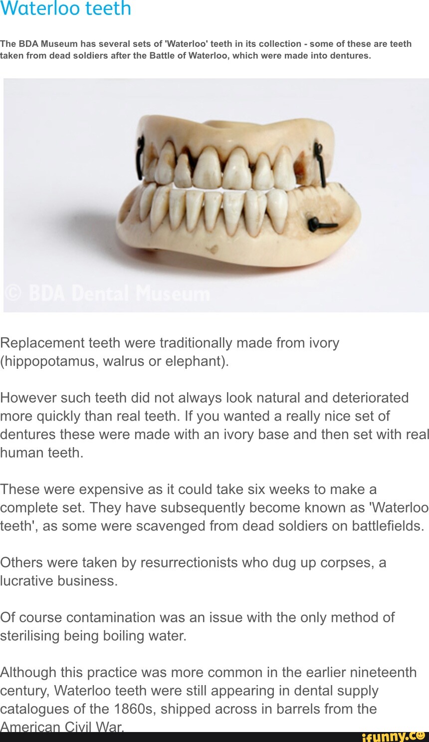 Waterloo Teeth The Bda Museum Has Several Sets Of 'waterloo' Teeth In 