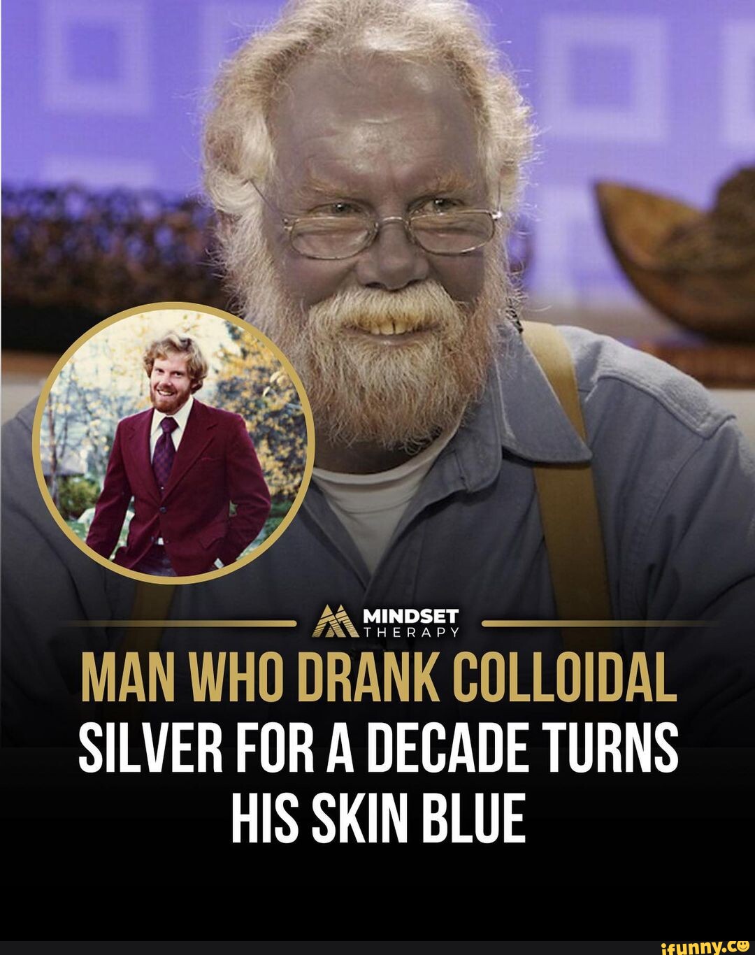 The man who turned blue 