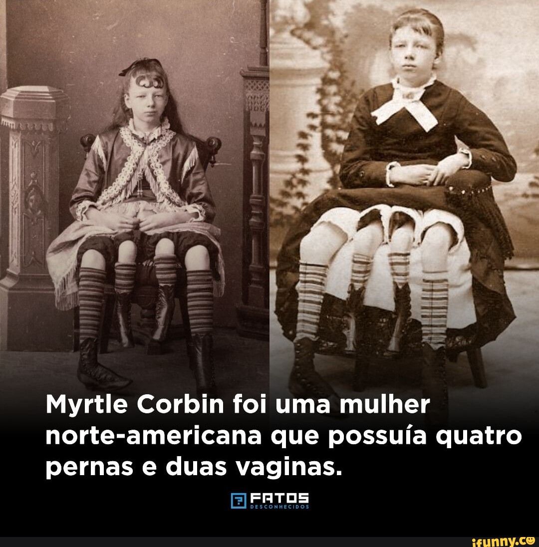 Myrtle Corbin foi uma mulher norte-americana que possuía quatro pernas e duas  vaginas. DESCONHECIDOS - iFunny Brazil