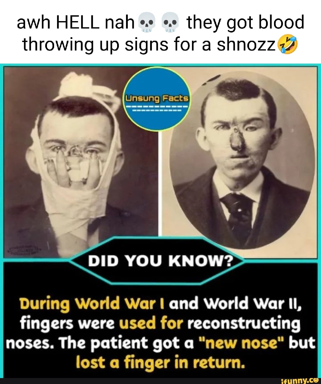 Awh HELL nah they got blood throwing up signs for a shnozz DID YOU KNOW