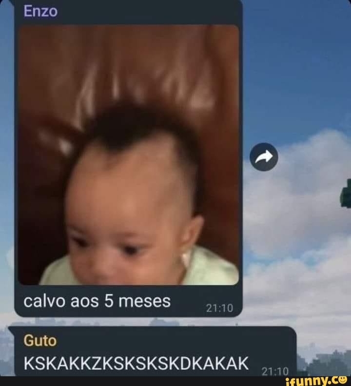 Tropa do bebê calvo 😻🥰😂 #foryou #foryoupage #neném #bebecalvo