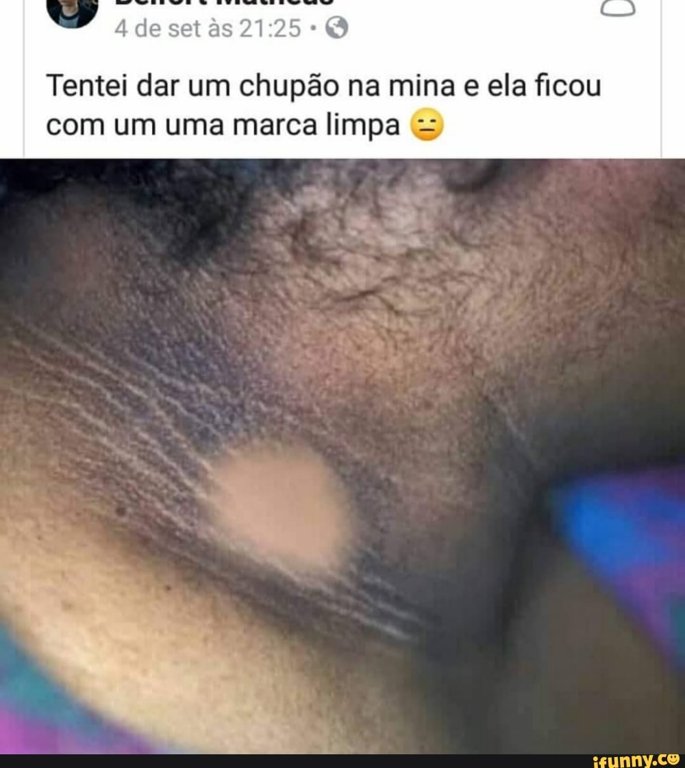 Tentei dar um chupão na mina e ela ficou com um uma marca limpa = - iFunny  Brazil