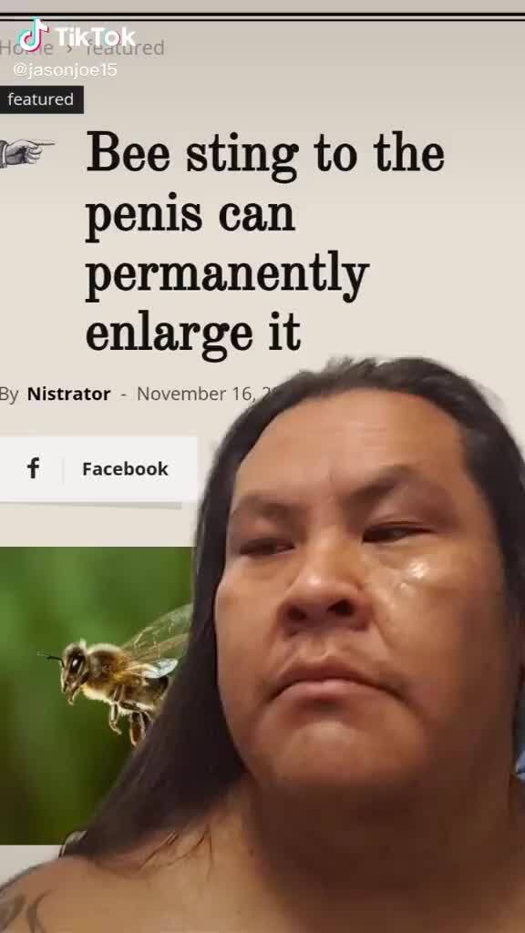 Bee sting to the penis can permanently enlarge it By Nistrator