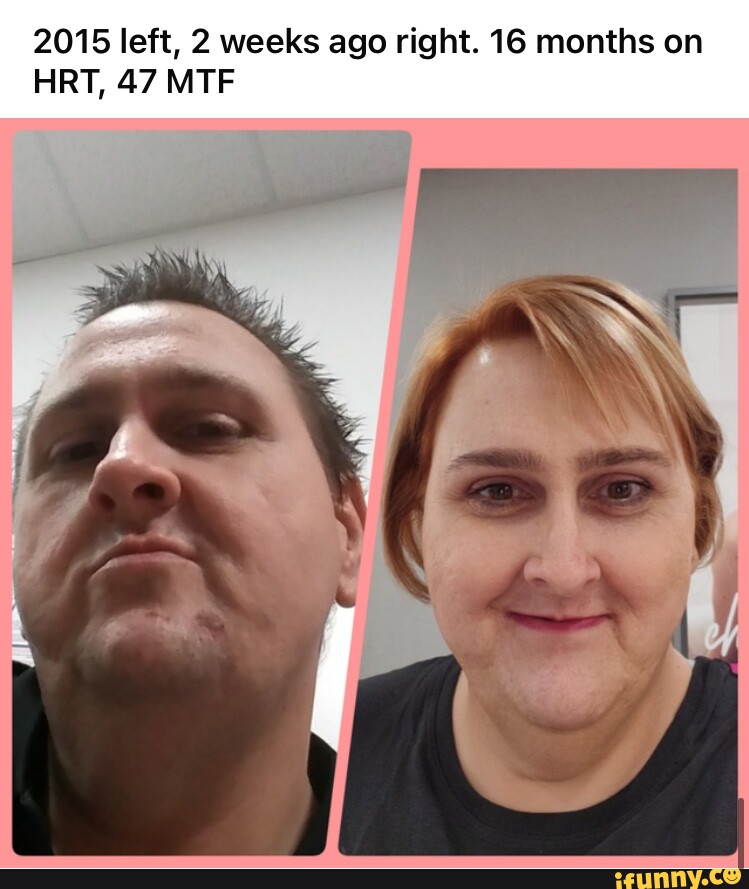 2015 left, 2 weeks ago right. 16 months on HRT, 47 MTF - iFunny Brazil