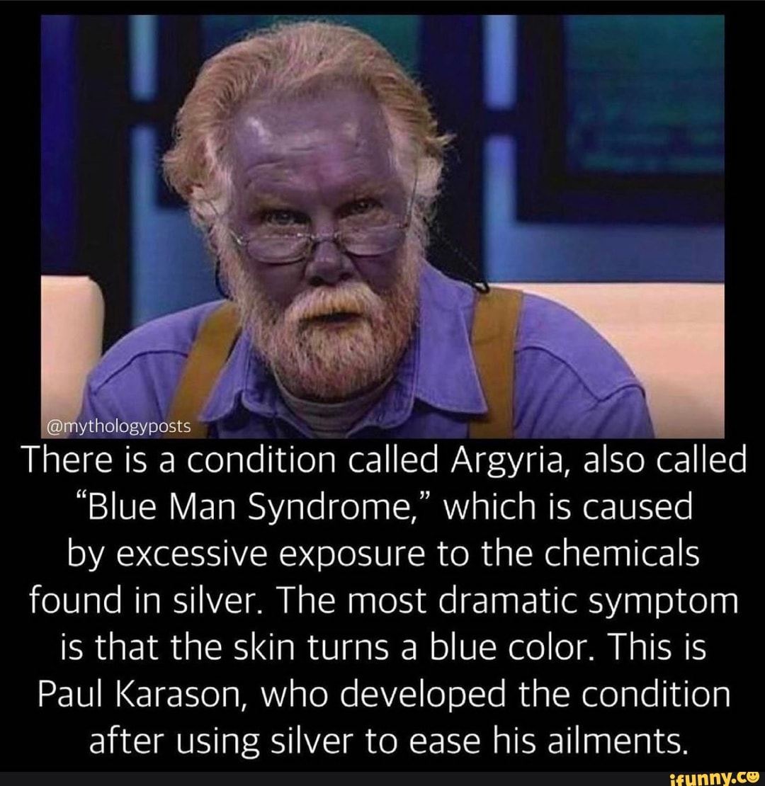 Strange case of Paul Karason who turned himself blue due to colloidal silver