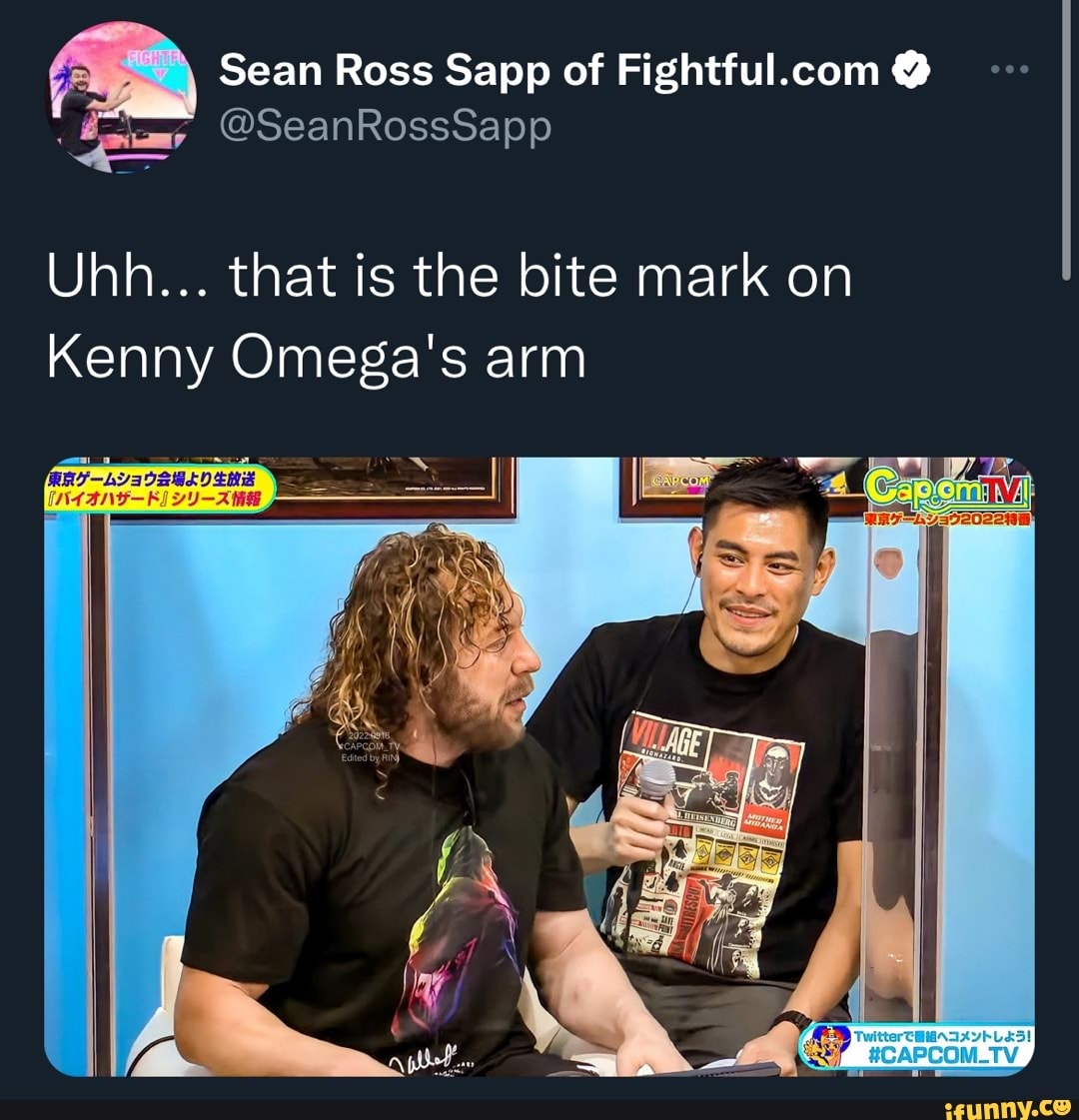 Sean Ross Sapp of SeanRossSapp ll Uhh that is the bite mark