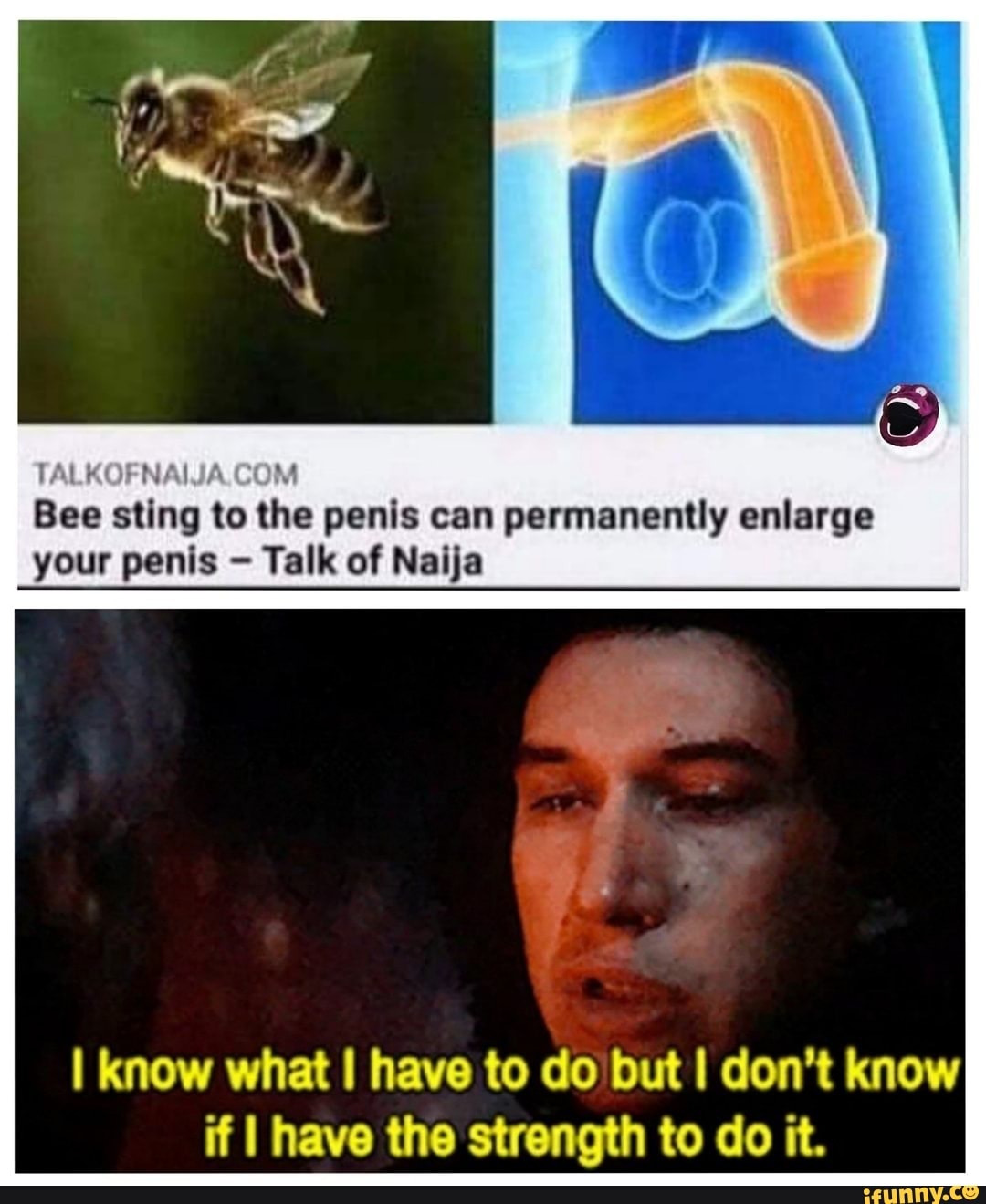 TALKOFNAIJA Bee sting to the penis can permanently enlarge your