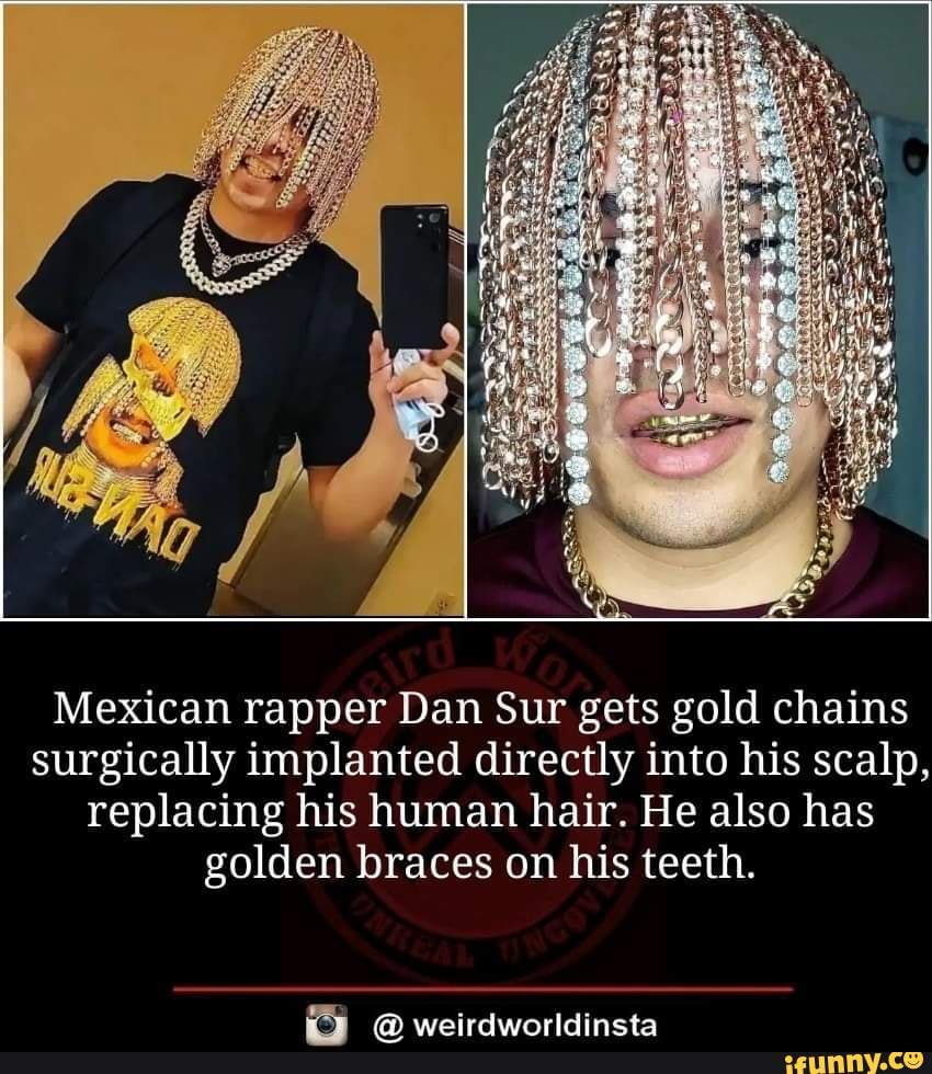 Rapper Dan Sur claims to be 'the first rapper to have gold hair implanted  in human history' | Daily Mail Online