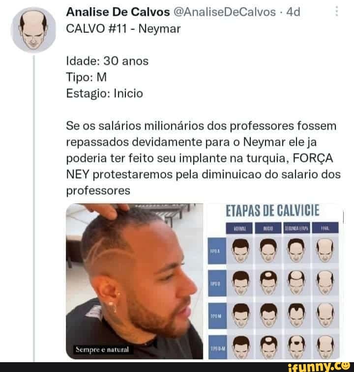 calvos memes