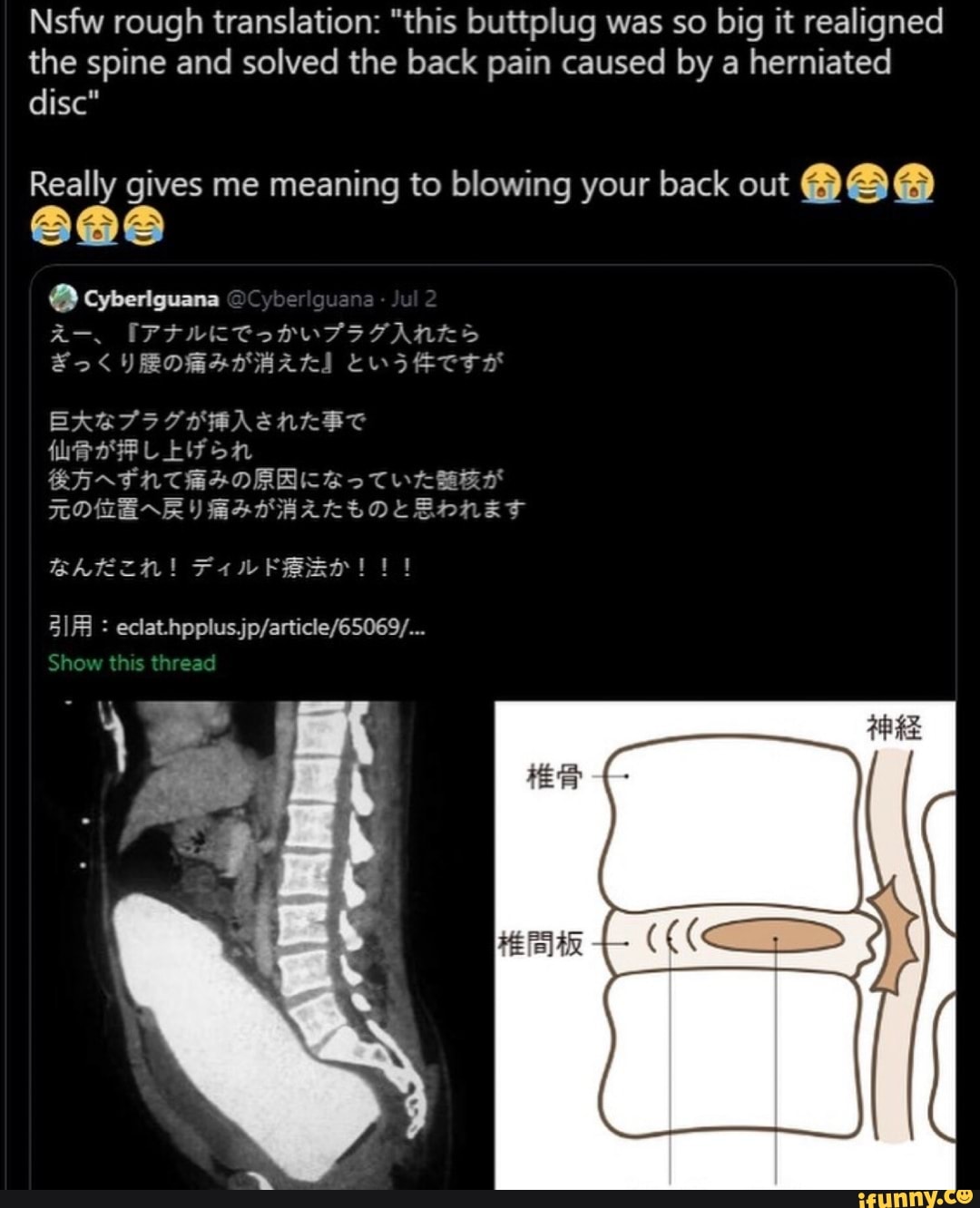 Nsfw rough translation: this buttplug was so big it realigned the spine  and solved the back