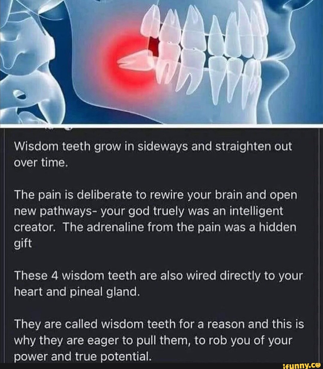 wisdom-teeth-grow-in-sideways-and-straighten-out-over-time-the-pain-is