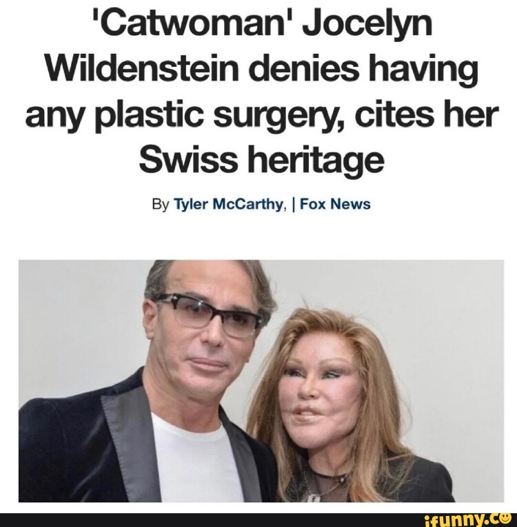 'Catwoman' Jocelyn Wildenstein Denies Having Any Plastic Surgery, Cites ...