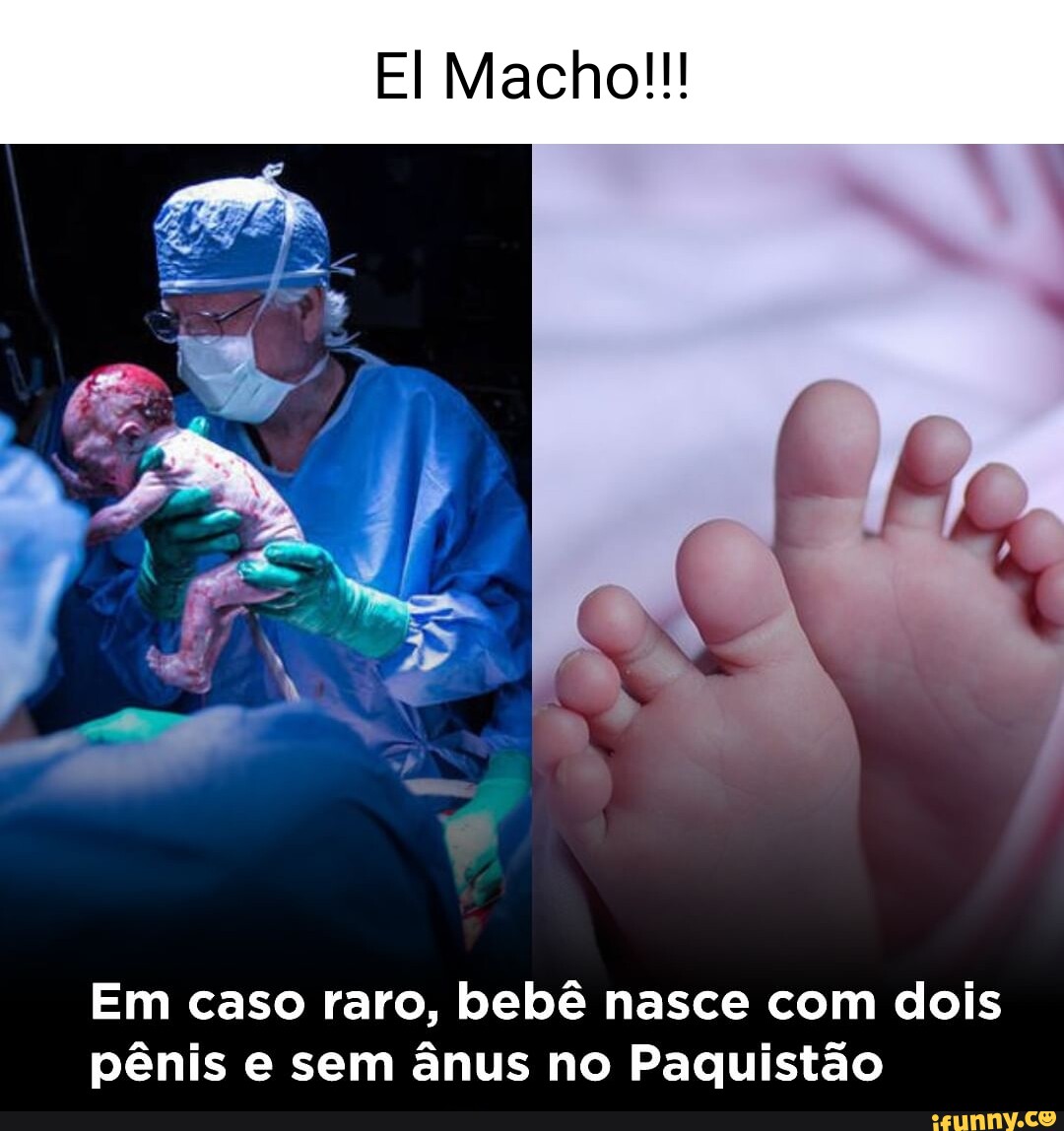 El Macho!!! Em caso raro, bebê nasce com dois pênis e sem ânus no Paquistão  - iFunny Brazil