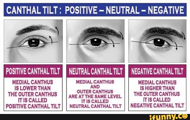 What is a canthal tilt?