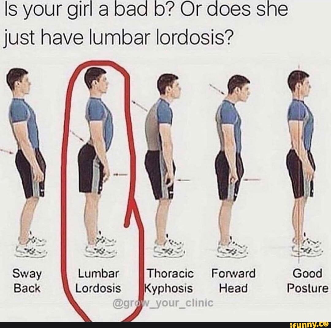 Lordosis Memes. Best Collection Of Funny Lordosis Pictures On IFunny Brazil