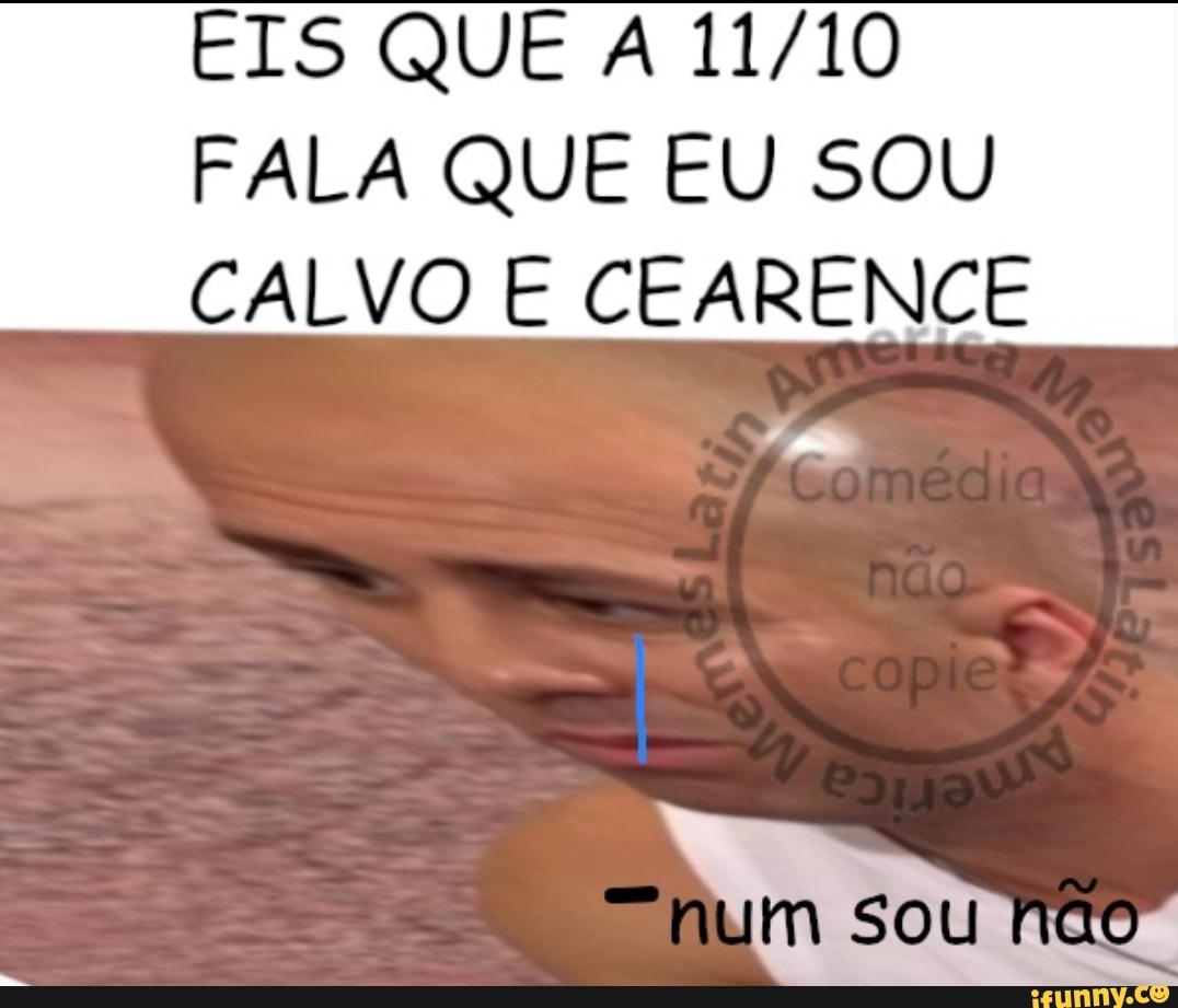 eu sou calvo? 