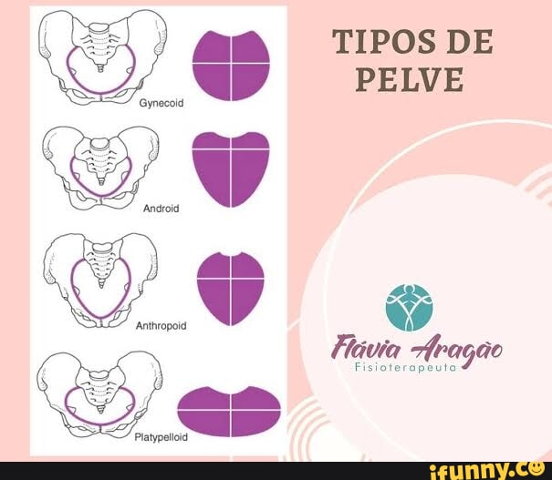 TIPOS DE PELVE - iFunny Brazil